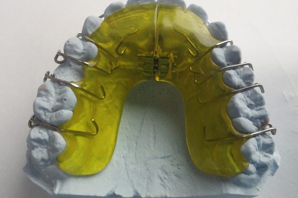 Jak wygląda przebieg wizyty u dentysty?