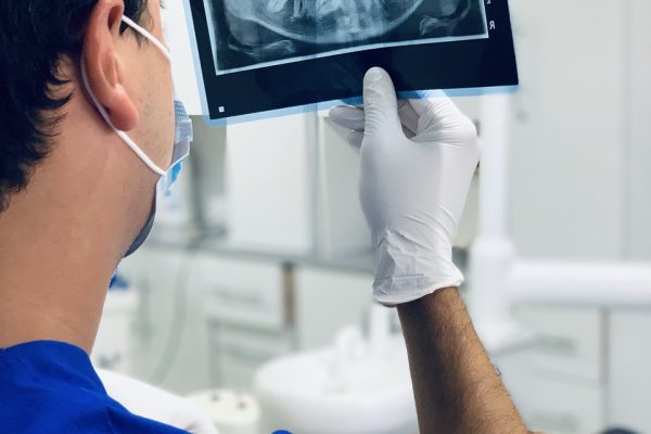 Ile kosztuje implant całej szczęki?