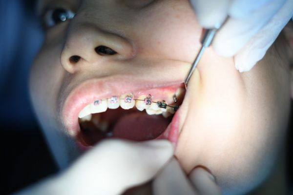 Leczenie dentystyczne Opole