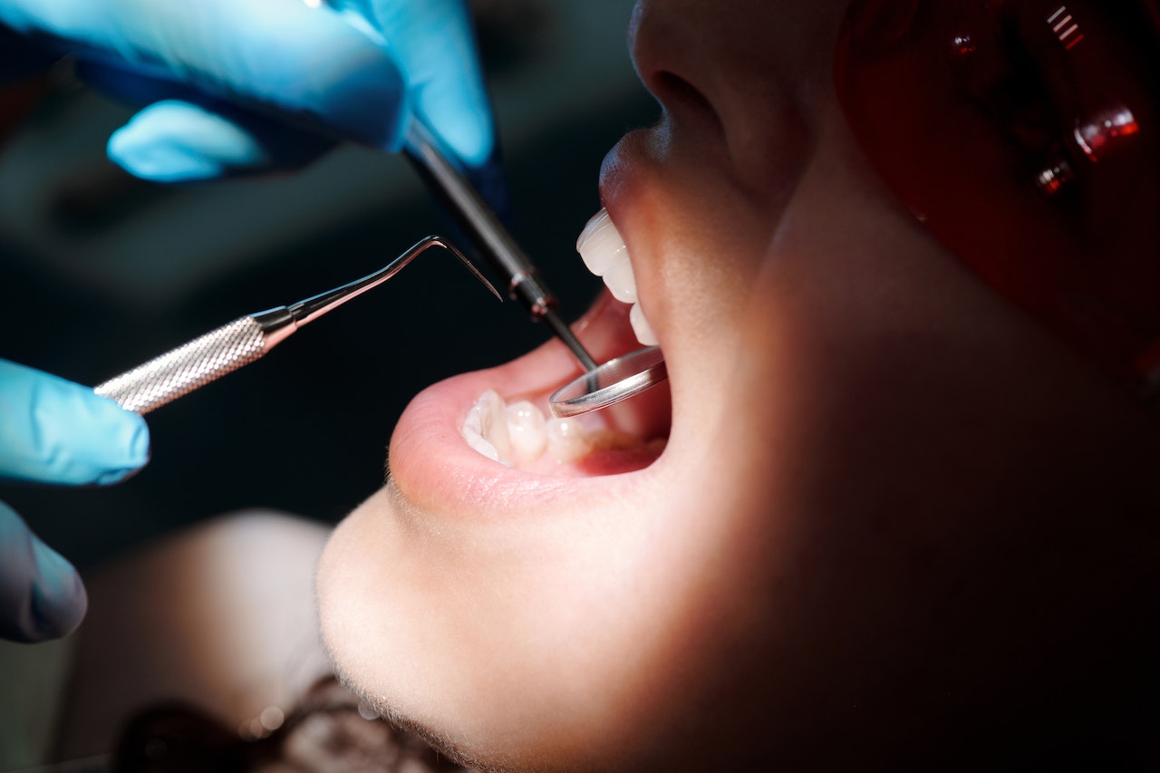 Czy warto wybrać się do stomatologa prywatnie?