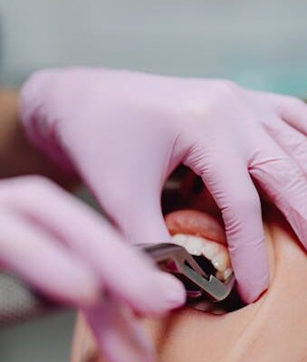 Wpływ diety na abrazję zębów: Jakie produkty szkodzą szkliwu?