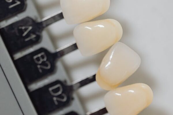 Licówki, a diastema – jak można rozwiązać problem?