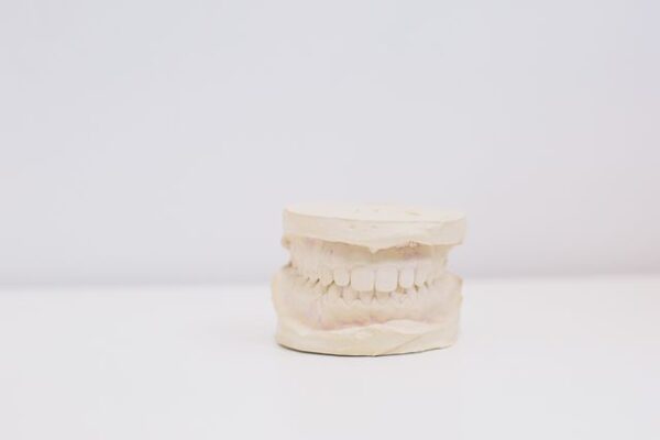 All on 4 – na czym polega odbudowa zębów na implantach?